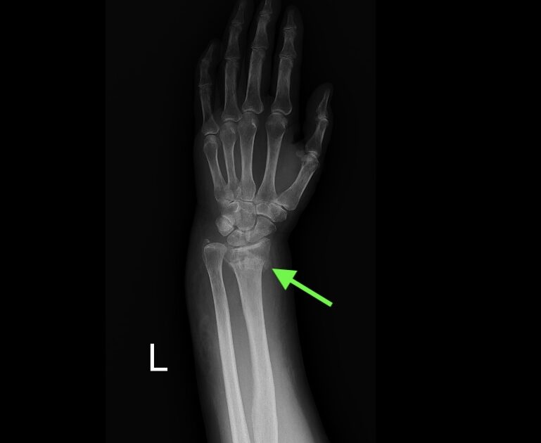 041c49ea20a96af48dbaae49a33b14